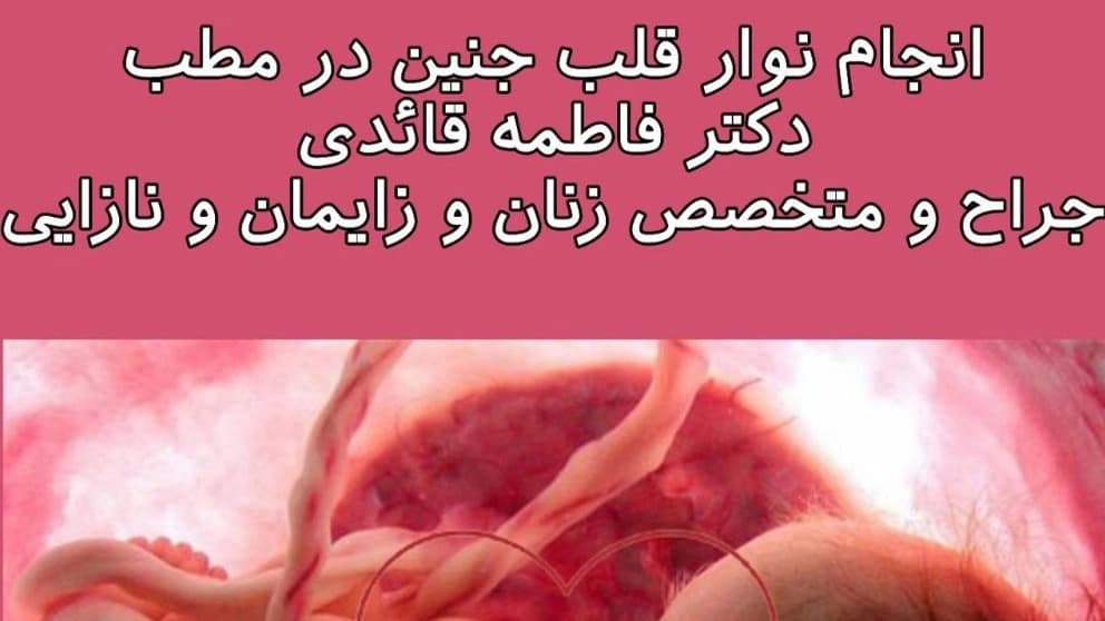 نوار قلب جنین